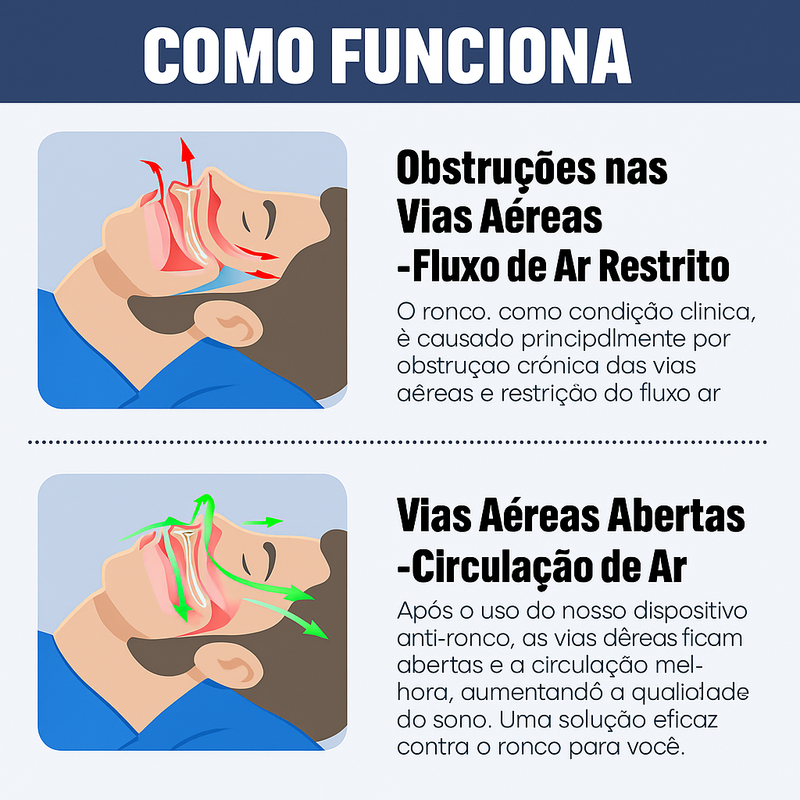 SleepGuard Pro — Anti Ronco Ajustável para Noites Silenciosas e Sono Restaurador!