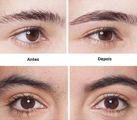 Caneta Depiladora Portáti